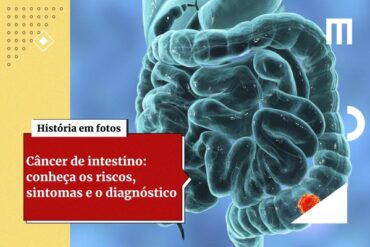 Cancer de intestino 3