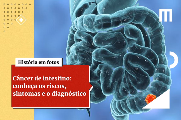Cancer De Intestino