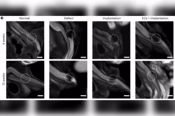 Cientistas Imprimem Penis Em 3d E Restauram Erecoes Em Porcos 2 E1741359774933