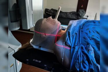 Mulher cancer na lingua enxaqueca 4