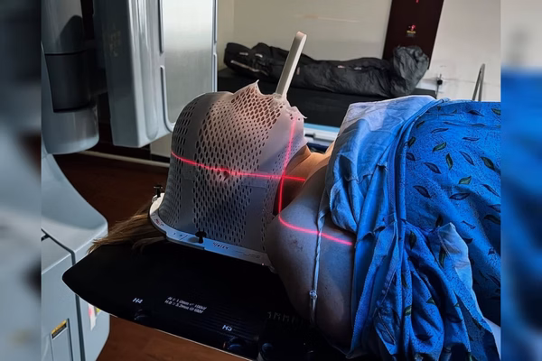 Mulher cancer na lingua enxaqueca 4