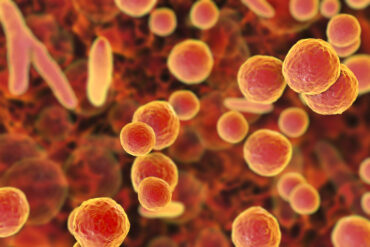 Mycoplasma pneumoniae
