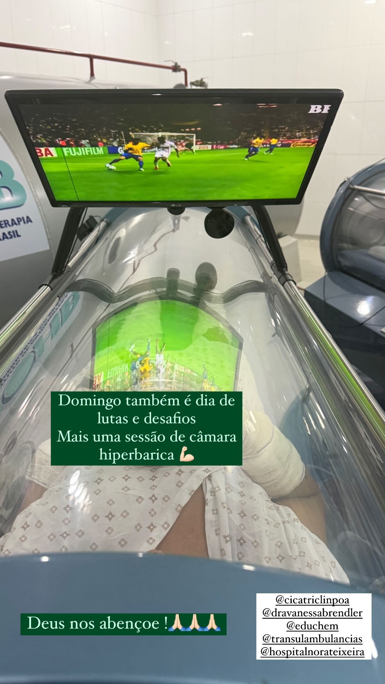 Lucio zagueiro queimadura2