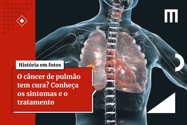 Cancer de pulmao