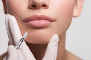 Mulher recebendo injecao de botox de labios