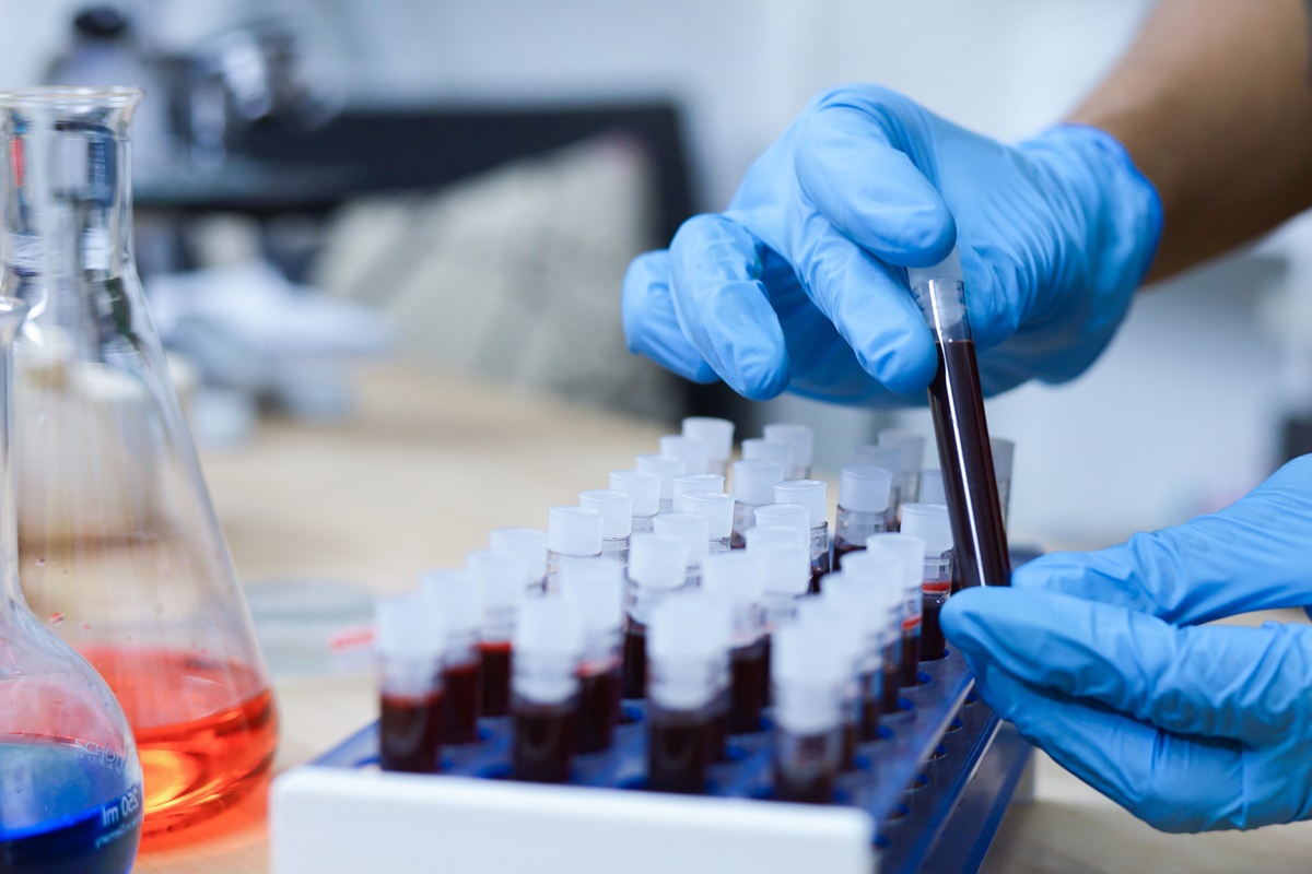 Teste de sangue