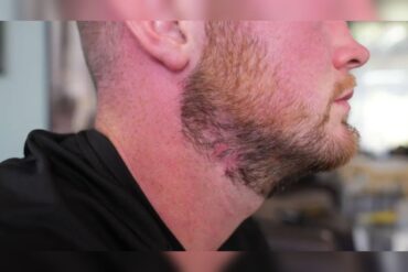 Geraint mullins cicatriz no pescoco