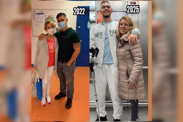 Homem faz cirurgia para ficar mais alto de 171 pra 195 1
