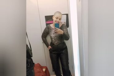 Linfoma rafaela 24 anos 3