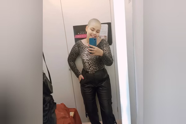 Linfoma rafaela 24 anos 3