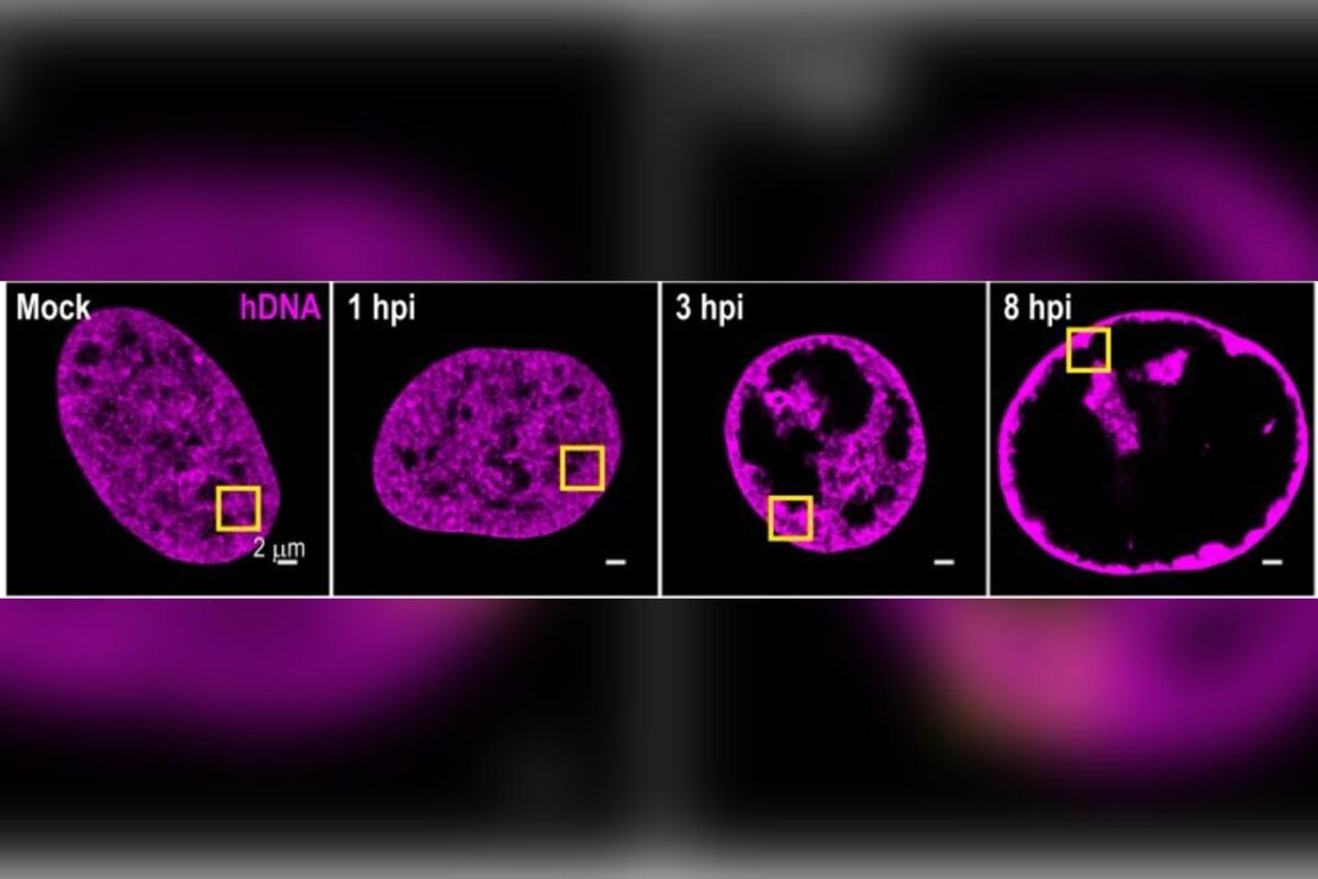 Virus da herpes brinca com designer de interiores com dna humano e1751381825989