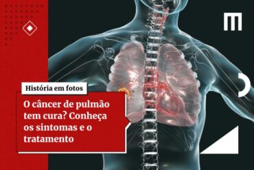 Cancer de pulmao
