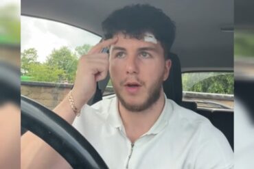 Jovem com cancer de pele na testa 3