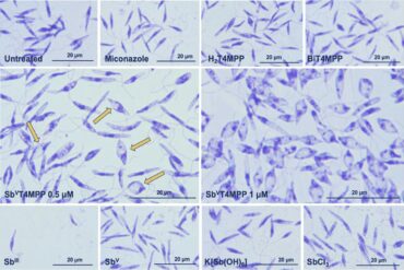 Leishmaniose parasitas