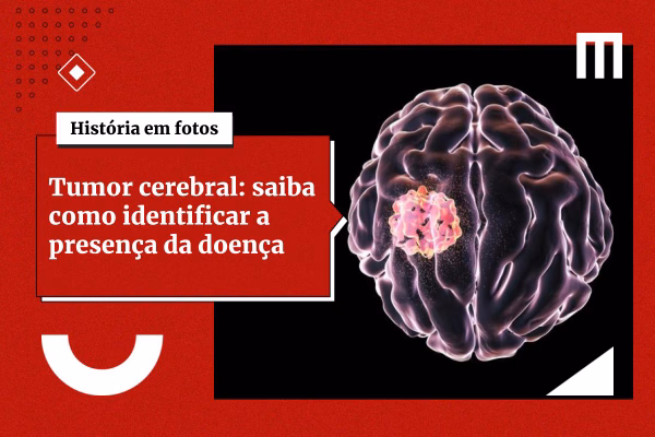 3 cards galeria de fotos 7 25 1