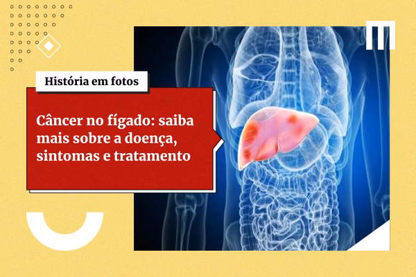 3 cards galeria de fotos 7 27