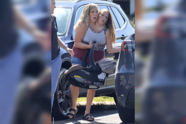 Gemeas siamesas bebe gravidas 2