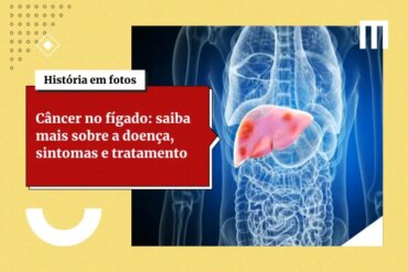 3 cards galeria de fotos 7 27 1