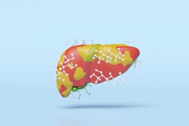 Gordura no figado 5 1