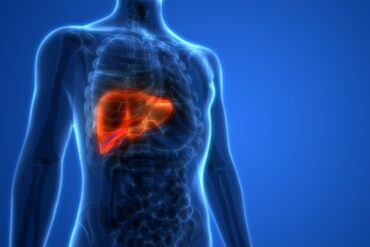 Gordura no figado 02