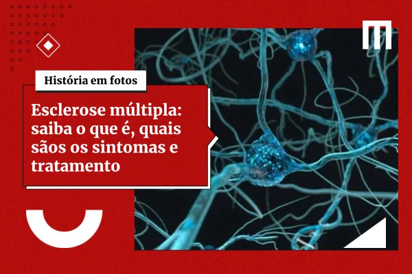 3 cards galeria de fotos 6 19